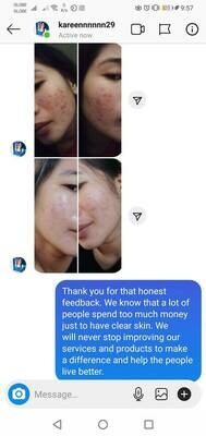 SAFERX™ Exosome-Boosted Stem Cell Ampoule | Advanced Cellular Renewal | Formulated in Seoul South Korea by Derma Lab Experts | FDA Approved