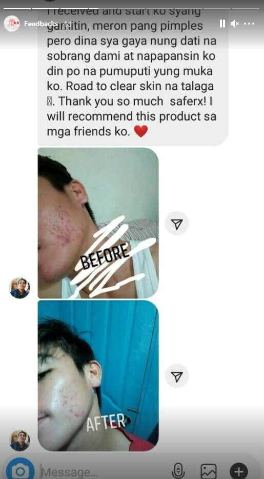 SAFERX 100% Natural Organic Serum Soap with Glutathione | Complete Deep Clean, Whitening and Anti-Aging Formula |  FDA Approved | Formulated by Saferx Lab Experts | Made in Korea | 6+5 FREE