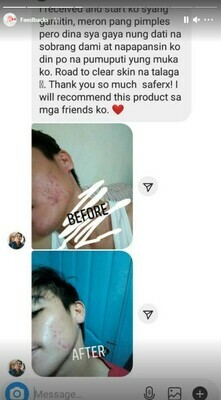 SAFERX 100% Natural Organic Serum Soap with Glutathione | Complete Deep Clean, Whitening and Anti-Aging Formula | FDA Approved | Formulated by Saferx Lab Experts | Made in Korea | 6+5 FREE
