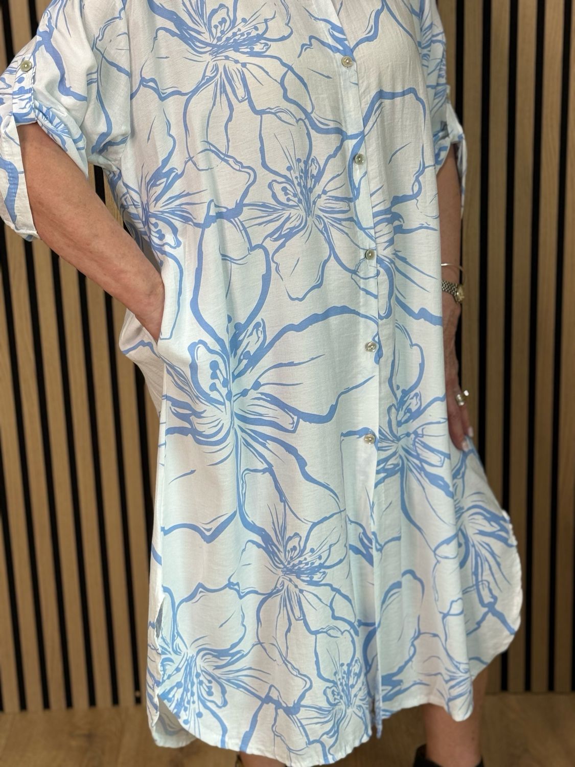 Floral Button Front Dress - Light Blue