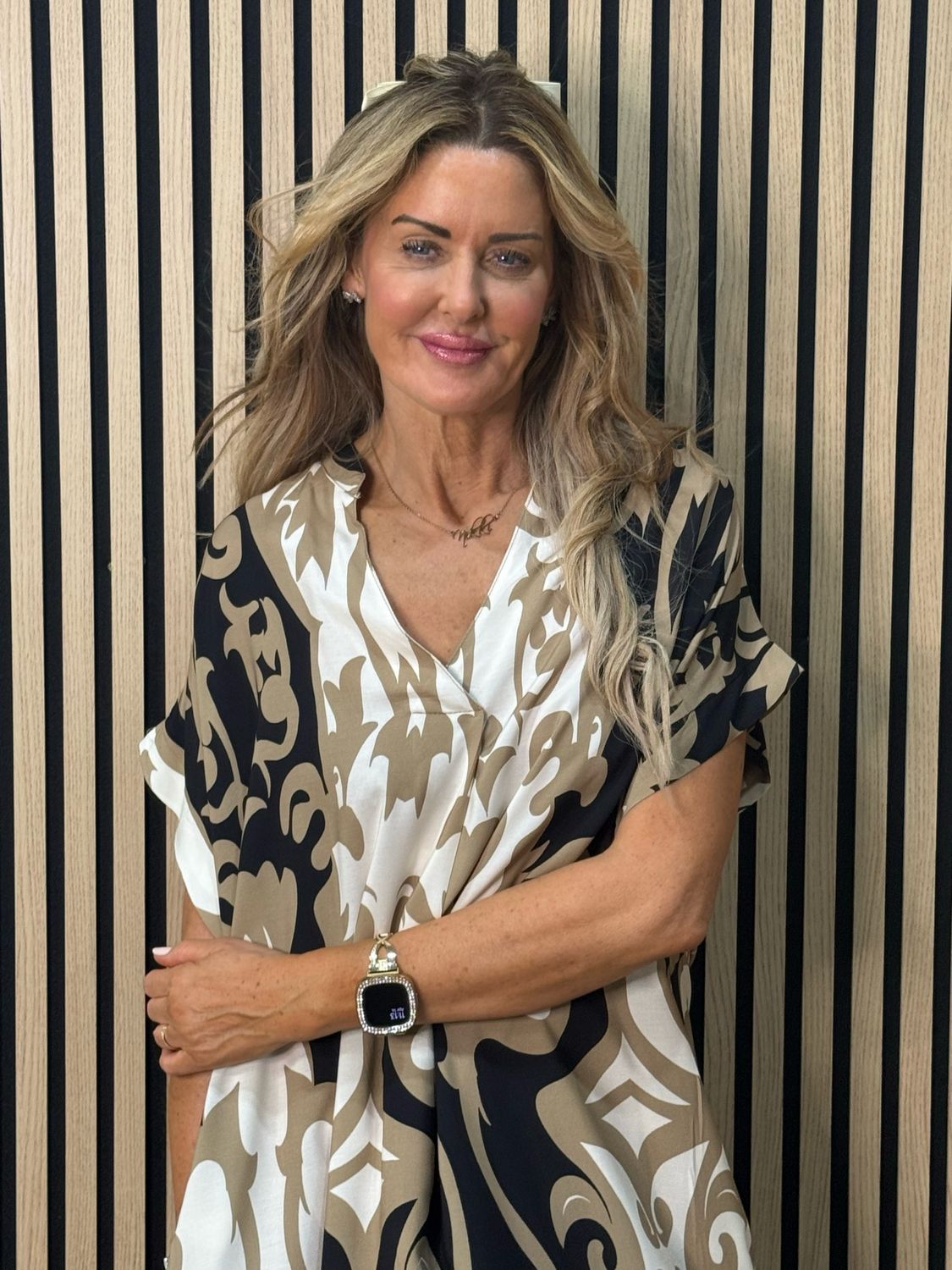 Printed Tunic Dress - Black/Taupe