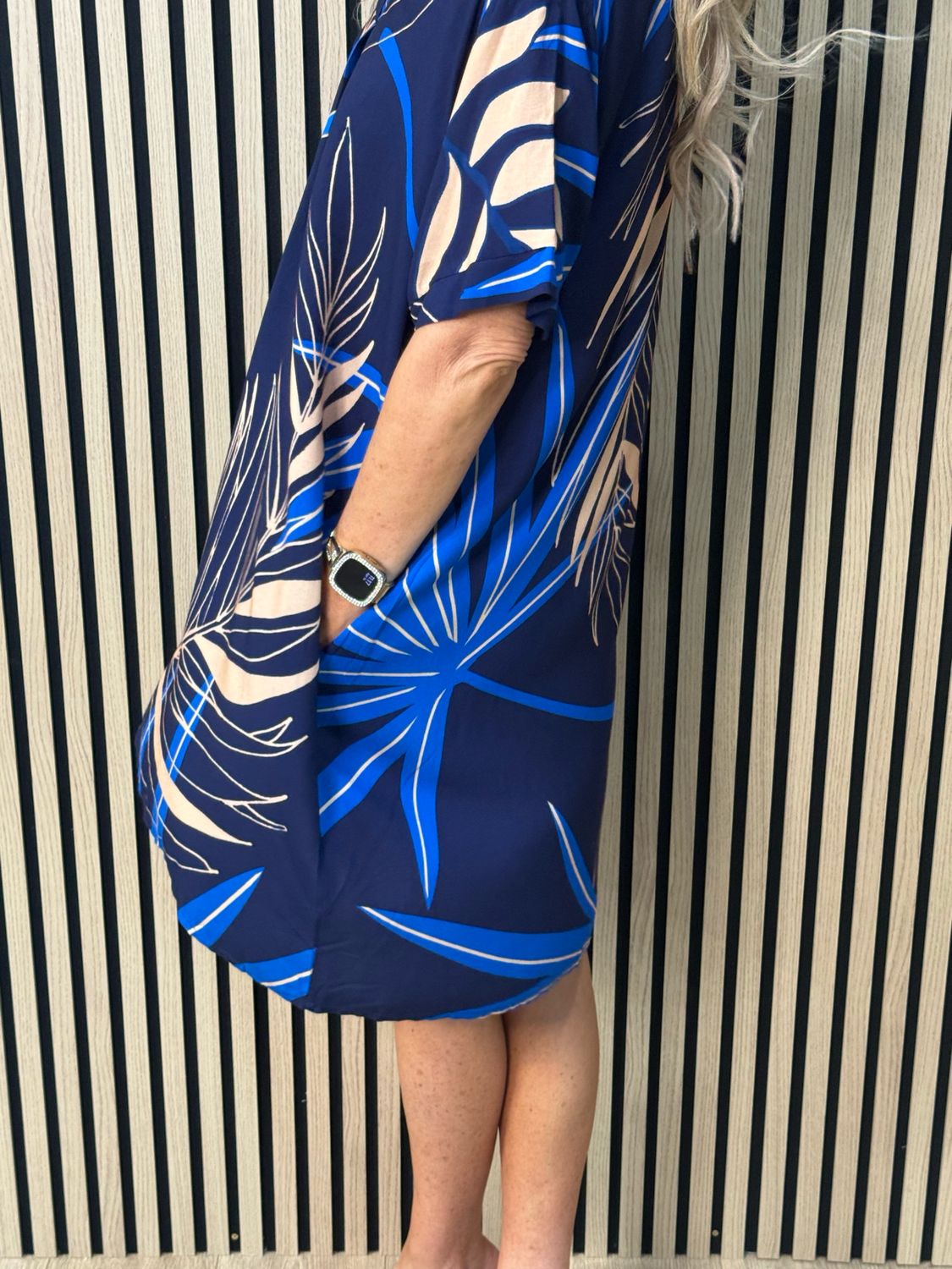 Tropical Print Tunic Dress - Blue