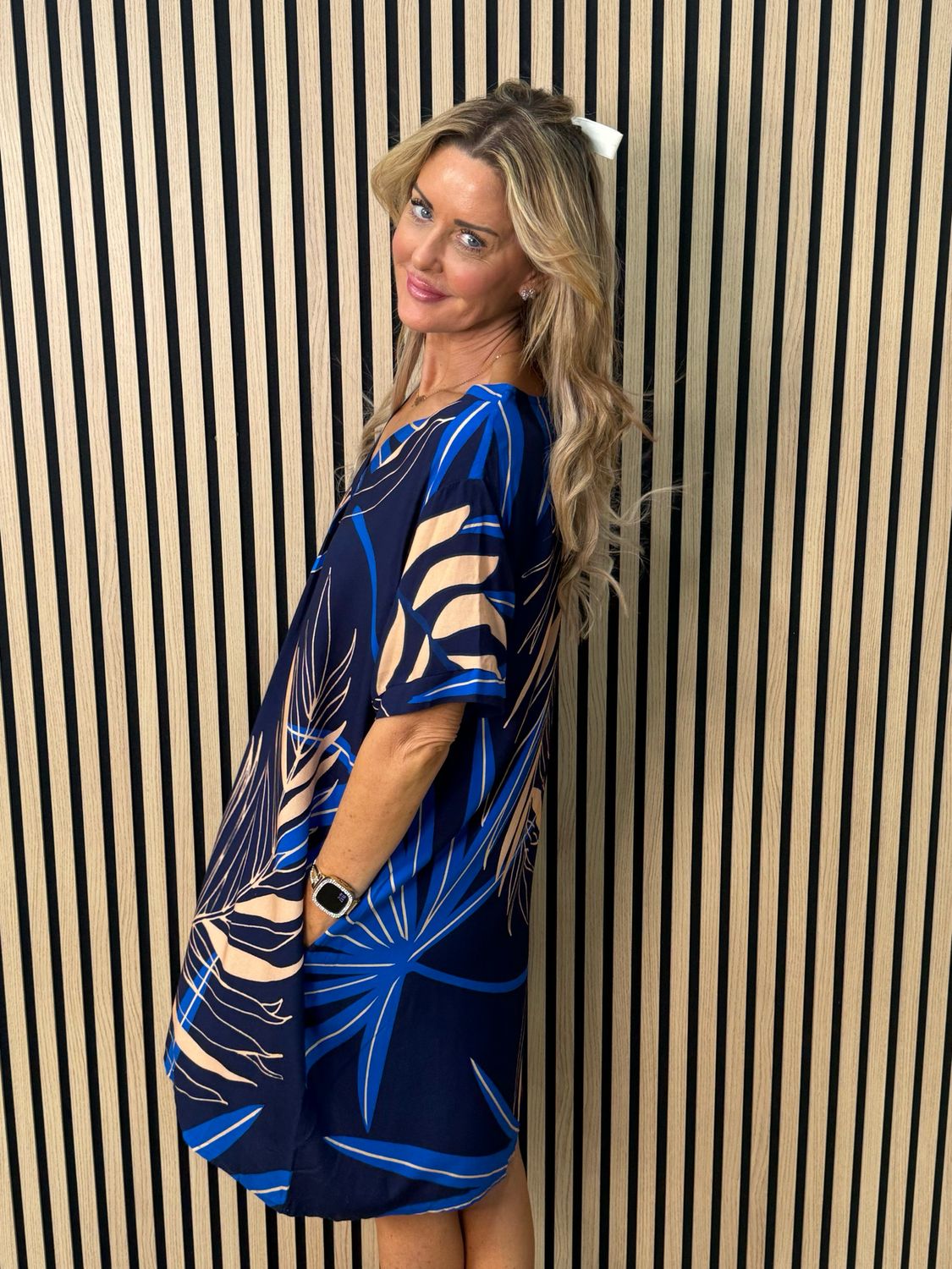 Tropical Print Tunic Dress - Blue