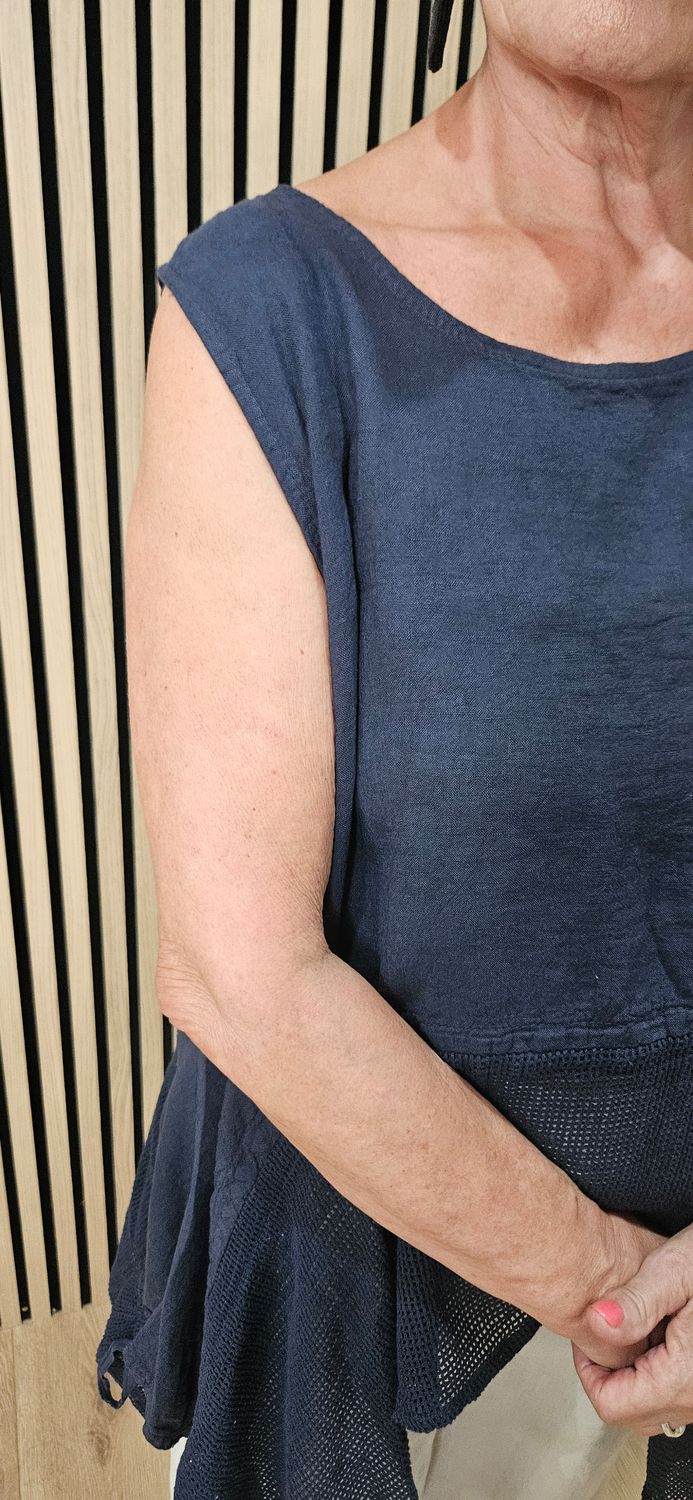 Linen Blend Mesh Detail Top – Navy