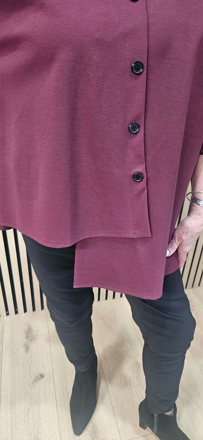 Layered Button-Detail Top