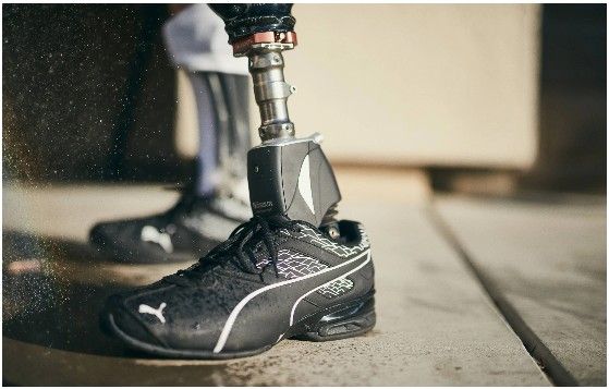 Consulta personalizada para pies protésico - Multimed Solutions Panamá