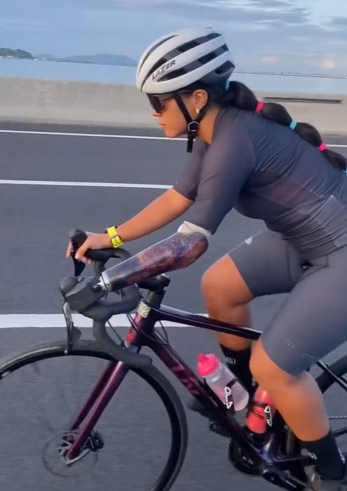 Confección de Prótesis de Miembro Superior