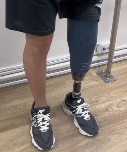 Confección de Prótesis de Miembro Inferior