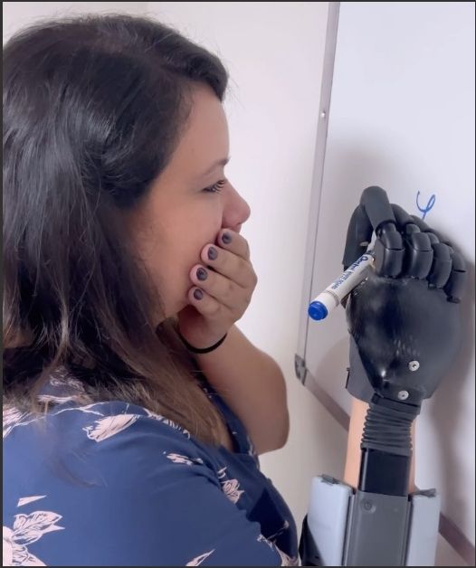 Consulta personalizada para prótesis robóticas y mecánicas de miembro superior