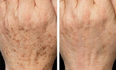 IPL - Hands