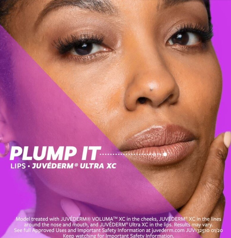 Filler - Juvederm Ultra PLUS (RN)
