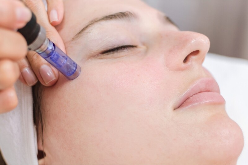 SKINPEN Micropen - Face