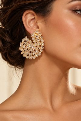Aretes