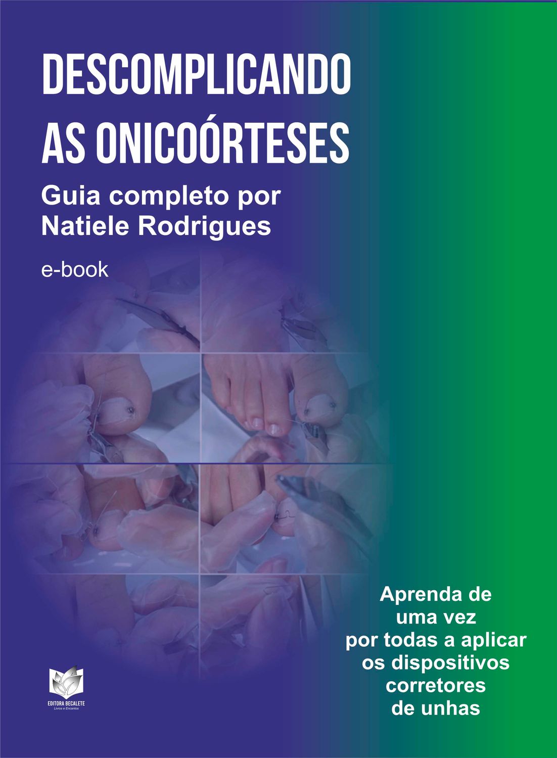 Descomplicando as onicoórteses - Guia completo por Natiele Rodrigues: aprenda de uma vez por todas a aplicar os dispositivos corretores de unhas