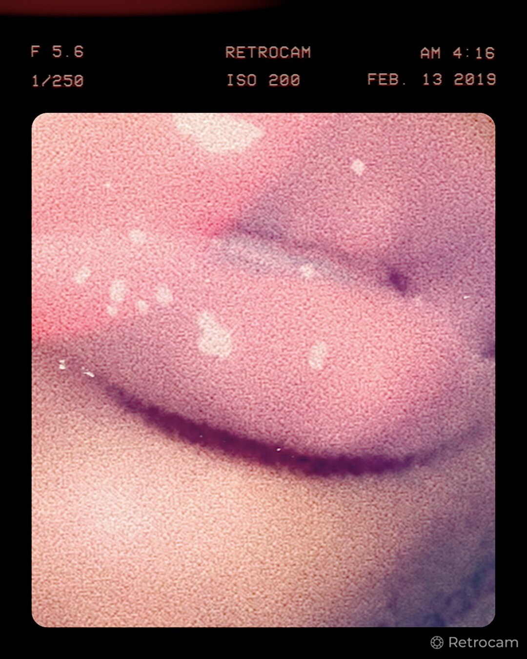 lipglosses