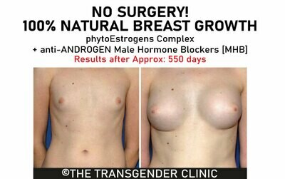 YOUR NATURAL BREAST GROWTH AND FEMINIZATION STARTS HERE: 

1.} PhytoEstrogens® Complex 
2.} Male Hormone Blocker
3.} PhytoEstrogel® 

ALL THREE Phases #1 #2 #3
Potency: ★★★★★+★★★★★+★★★★★