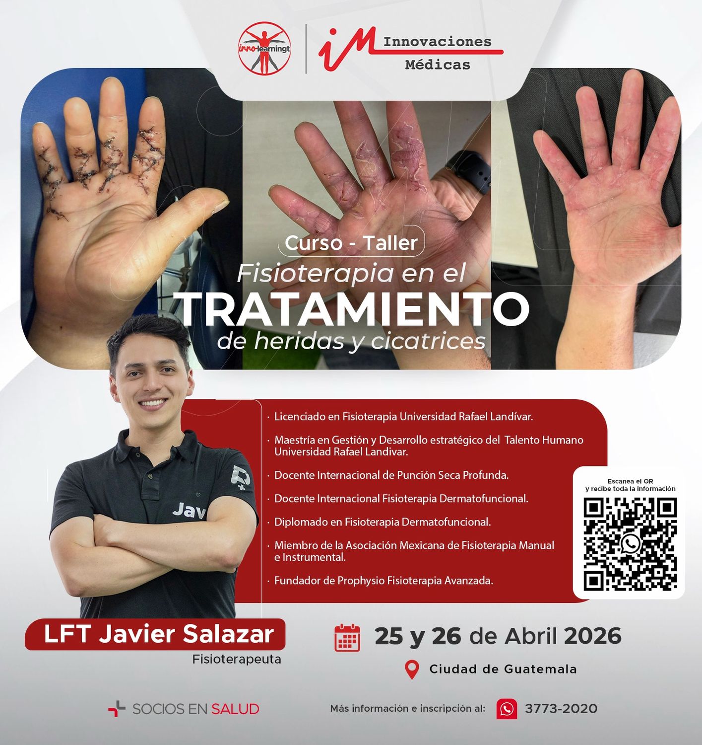 FISIOTERAPIA EN EL TRATAMIENTO DE HERIDAS Y CICATRICES