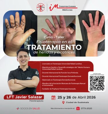 FISIOTERAPIA EN EL TRATAMIENTO DE HERIDAS Y CICATRICES