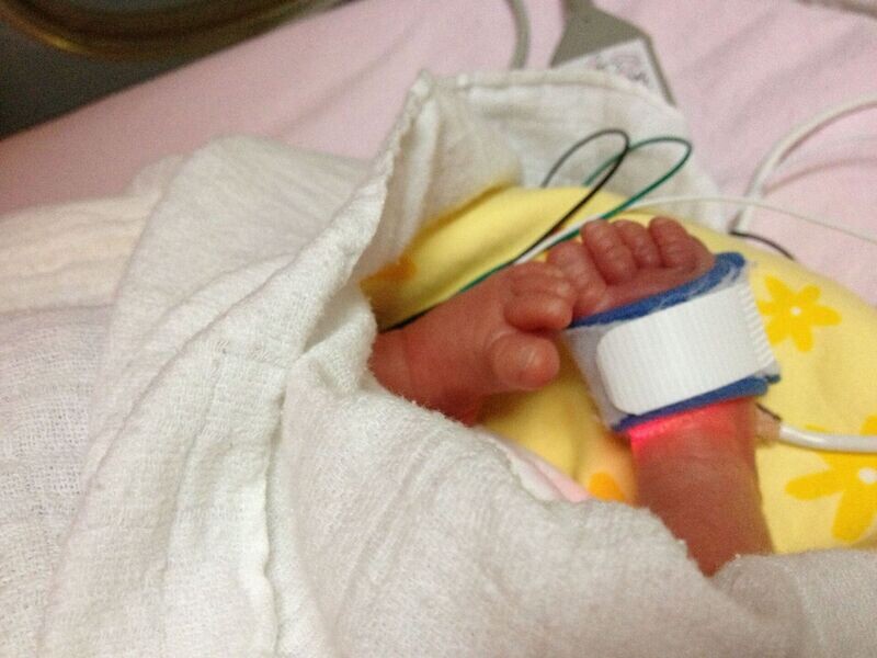 Breastfeeding a Baby with Heart Disease