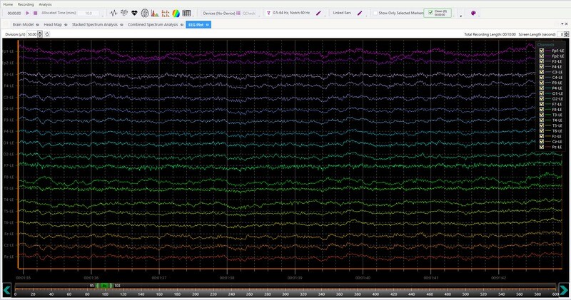 NeuroField Analysis Software Suite