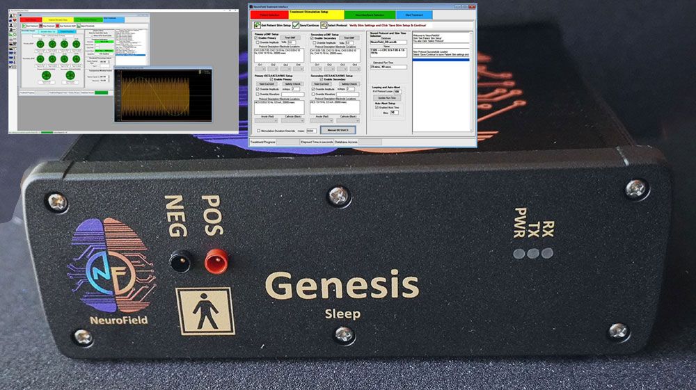 NueroField Genesis Sleep with Neurofield64 Software