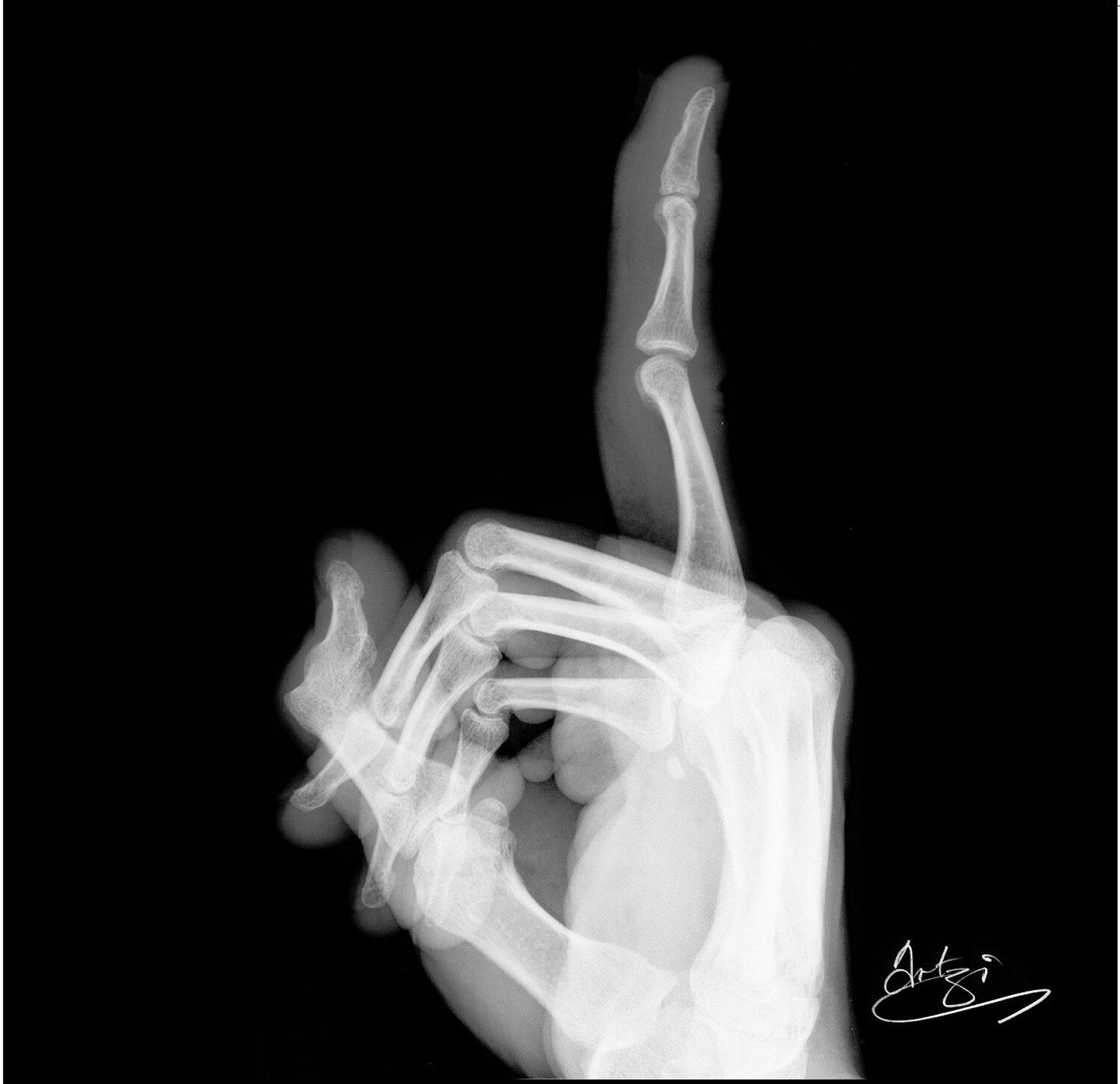 X-ray Finger Greeting Card