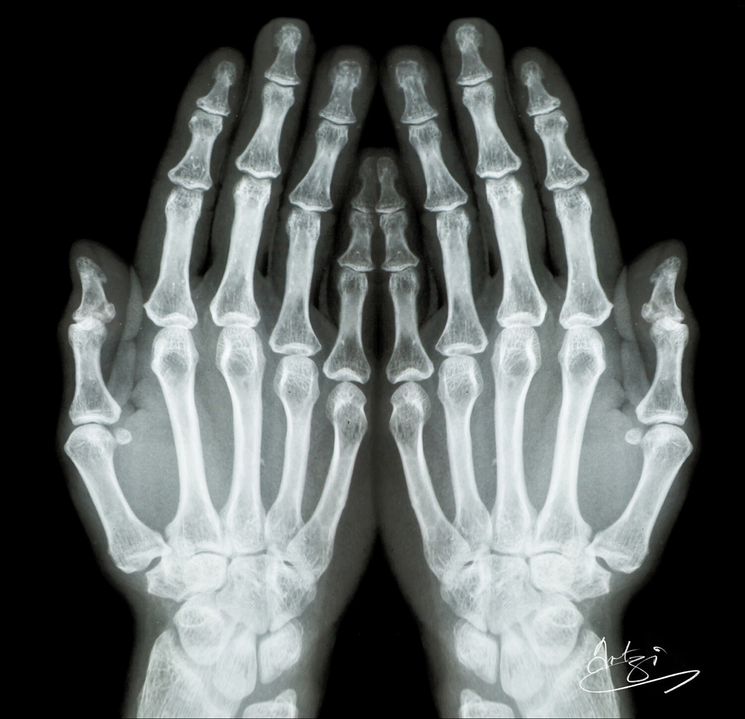 X-ray Hands Greeting Card