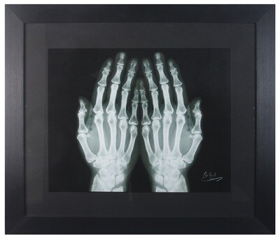 Hands of Prayer X-ray in Black Frame