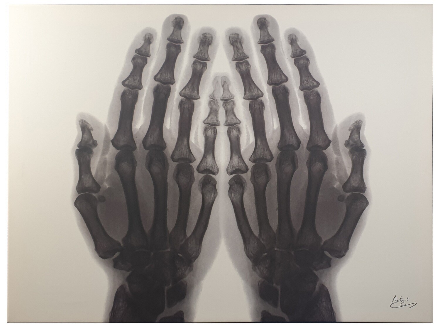 Dua Hands X-ray Art Original Giclee Canvas