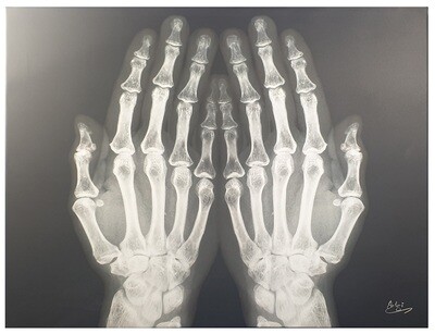 Dua Hands X-ray Art Original Giclée Canvas