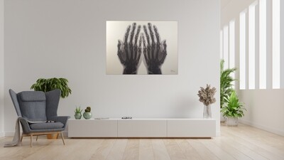 Dua Hands X-ray Art Original Giclee Canvas