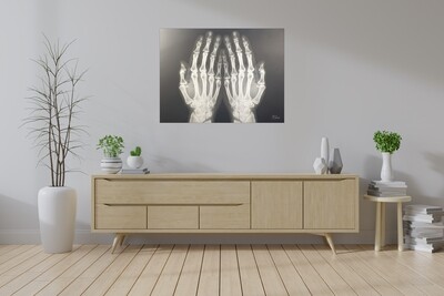 Dua Hands X-ray Art Original Giclée Canvas