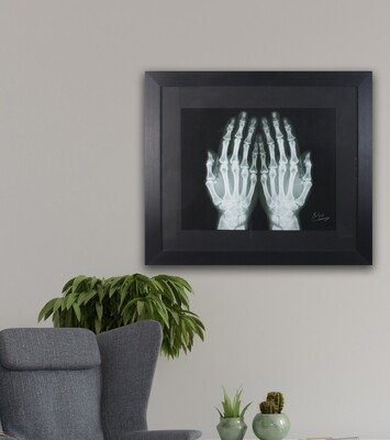 Hands of Prayer X-ray in Black Frame