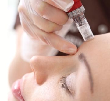 Summer Glow Promo - Microneedling + AOX Serum free!
