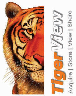 TigerView Dental Image Software