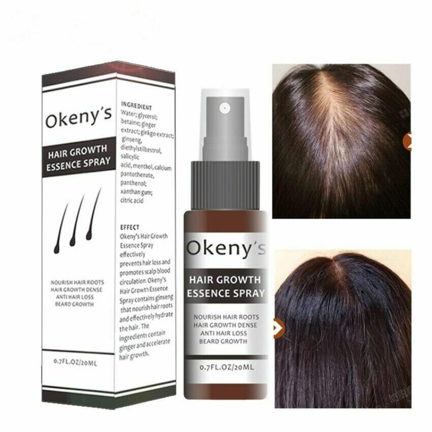 Ginger Hair Growth Essence Spray 20m