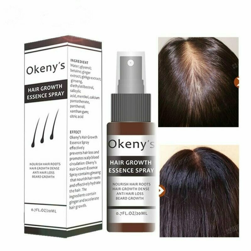 Ginger Hair Growth Essence Spray 20m