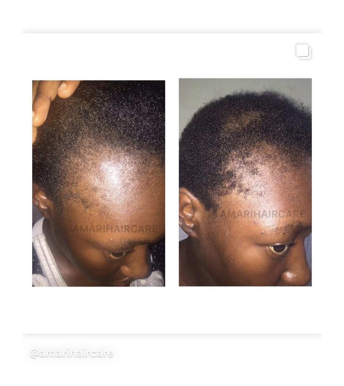 HAIR GROWTH - SET (ALL HAIR TYPES)