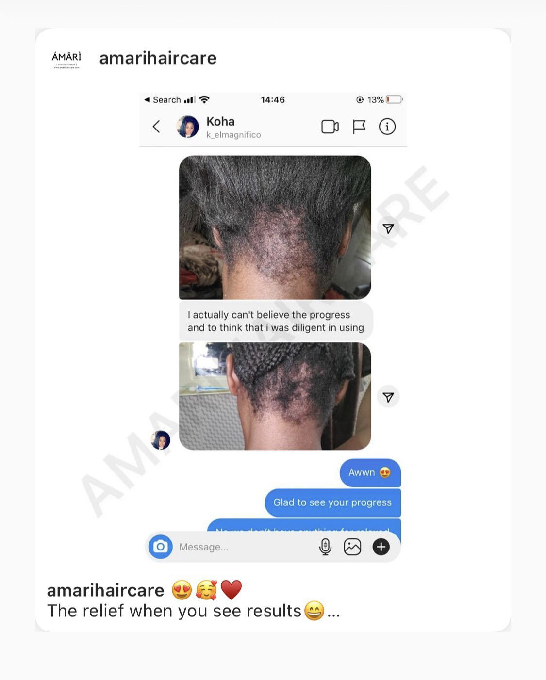 HAIR GROWTH - SET (ALL HAIR TYPES)