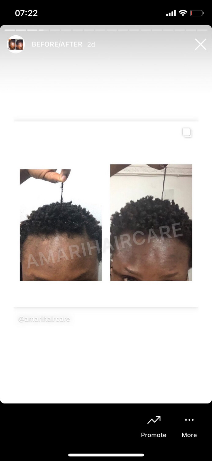 HAIR GROWTH - SET (ALL HAIR TYPES)
