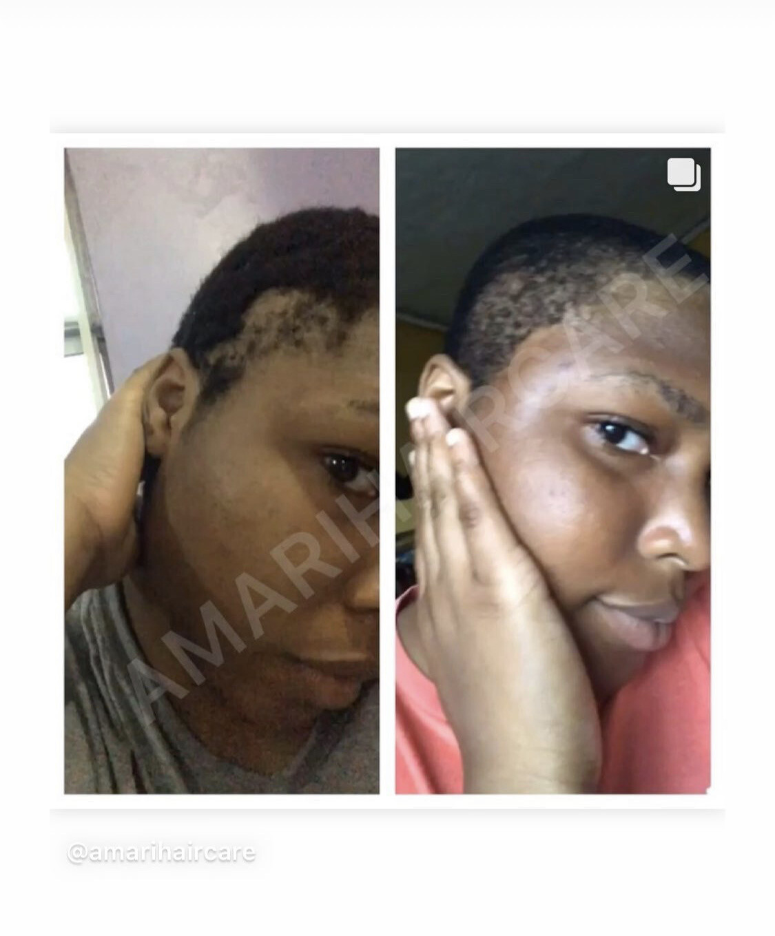 HAIR GROWTH - SET (ALL HAIR TYPES)