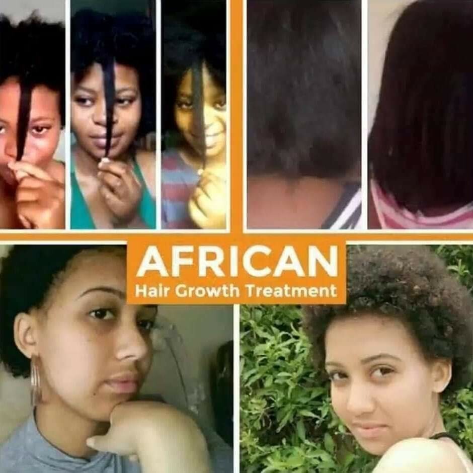 AFRICAN HAIR GROWTH TREATMENT