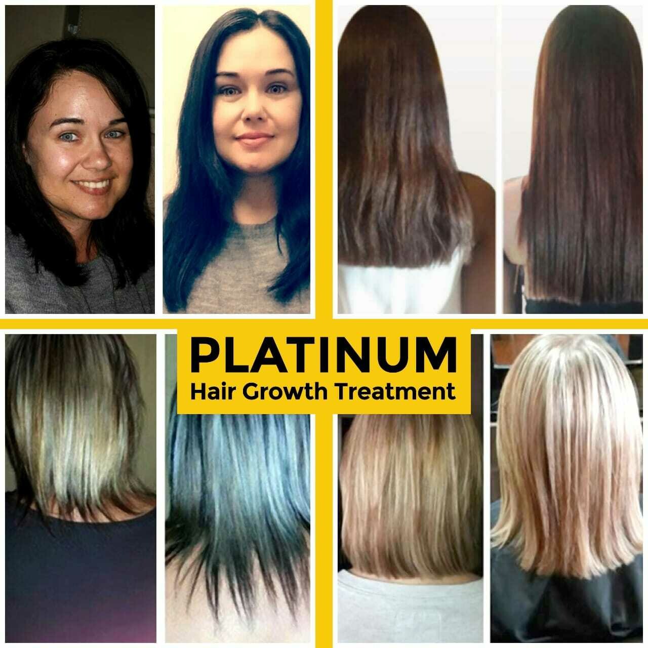 PLATINUM HAIR GROWTH TREATMENT