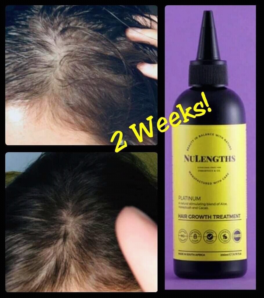 PLATINUM HAIR GROWTH TREATMENT