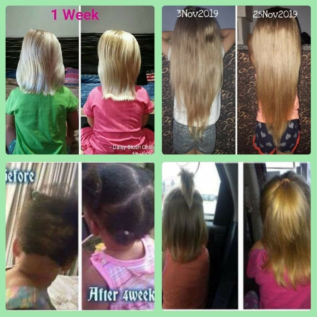 JUNIOR HAIR GROWTH TREATMENT