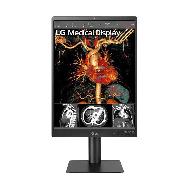 LG 21'' Medical Monitor