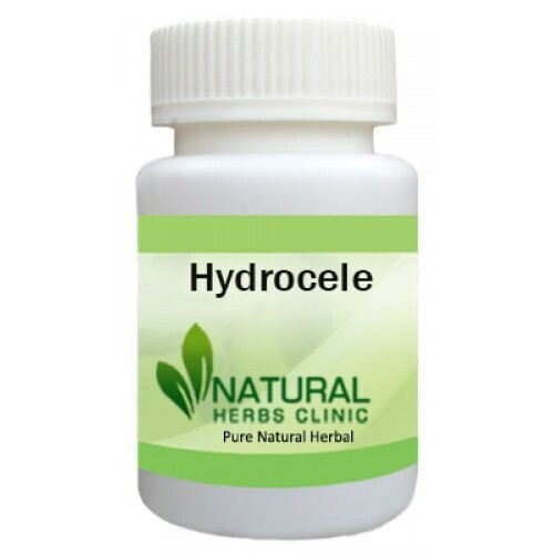 Herbal Product for Hydrocele