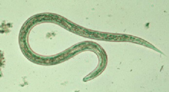 ​Parasites and Your Health
