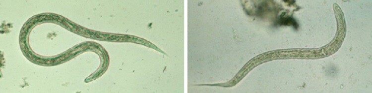 ​Parasites and Your Health