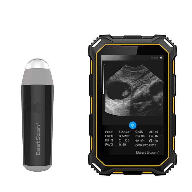 Bestscan S3 Handheld Wireless Ultrasound - Pregnancy Test, Back-fat